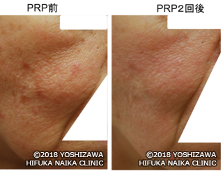 坂井の最終写真.png